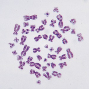 사람염색체 (영구프레파라트)